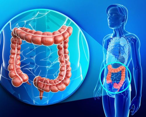 Is-colon-cancer-curable