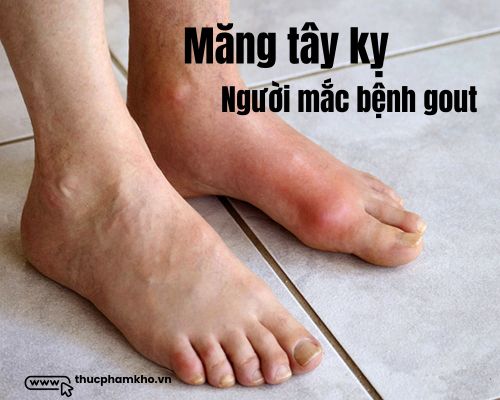 mang-tay-ky-nguoi-mac-benh-gout